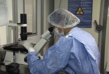 Avanços na ciência: novos casos de remissão do HIV após transplante de células-tronco