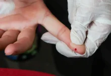 Brasil alcança marco histórico na eliminação da transmissão vertical de hepatite B