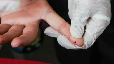 Brasil alcança marco histórico na eliminação da transmissão vertical de hepatite B