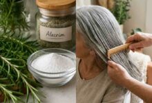 Cabelos brancos: dermatologistas alertam para os riscos da popular mistura de bicarbonato e alecrim