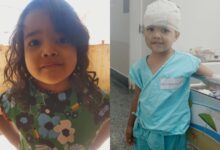 Ataque de pit bull em casa deixa menina de 4 anos hospitalizada em Goiânia