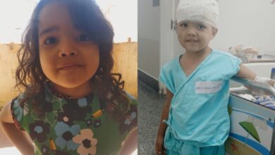 Ataque de pit bull em casa deixa menina de 4 anos hospitalizada em Goiânia