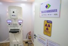 Cirurgias plásticas mamárias no SUS registram alta de 54% em uma década