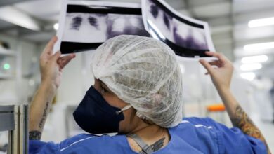 Cura do câncer de pulmão é rara com diagnóstico tardio no SUS