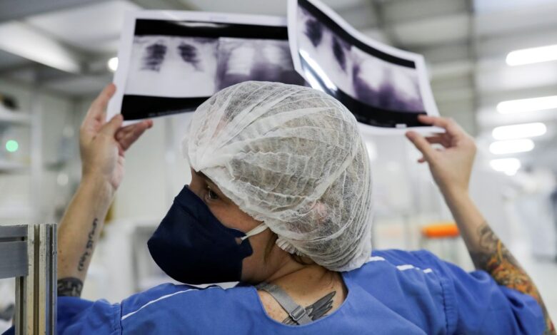 Cura do câncer de pulmão é rara com diagnóstico tardio no SUS