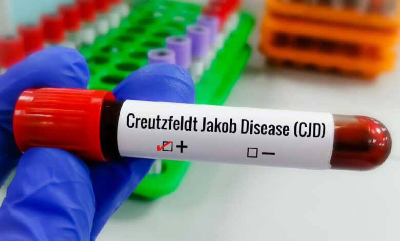 Doença de Creutzfeldt-jakob: entenda os desafios da condição rara e degenerativa