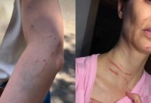 Enfermeira é agredida por paciente após negar atendimento em hospital lotado no DF