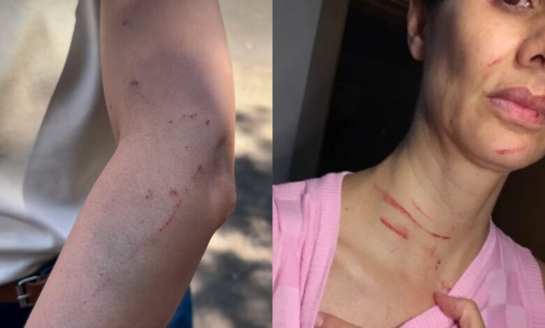 Enfermeira é agredida por paciente após negar atendimento em hospital lotado no DF