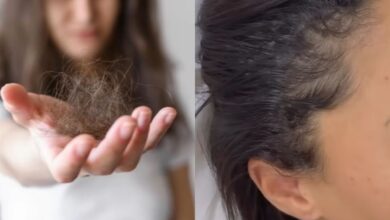 Queda de cabelo: por que buscar diagnóstico médico antes de iniciar tratamentos
