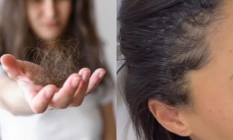 Queda de cabelo: por que buscar diagnóstico médico antes de iniciar tratamentos