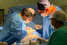 Siamesas Maria Helena e Maria Eva iniciam jornada para separação com implante de expansores