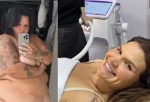 Thaís Carla busca tecnologias estéticas para tratar flacidez após perda de 100 kg