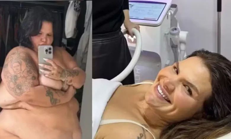 Thaís Carla busca tecnologias estéticas para tratar flacidez após perda de 100 kg