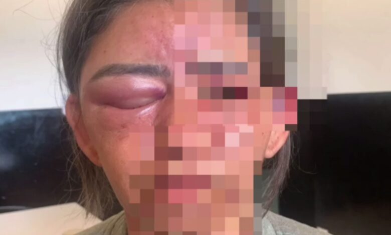 Homem é preso após estrangular e espancar mãe de amigo em Cristalina