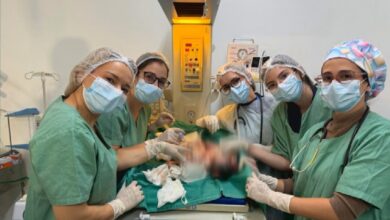 Nascimento de gêmeos siameses em Goiânia desafia medicina e traz esperança