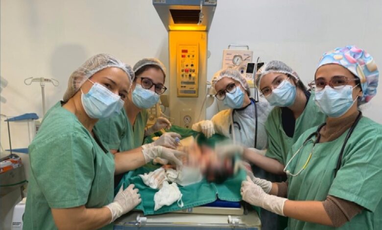 Nascimento de gêmeos siameses em Goiânia desafia medicina e traz esperança