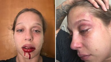 Violência doméstica em Goiânia: jovem denuncia agressão brutal de empresário