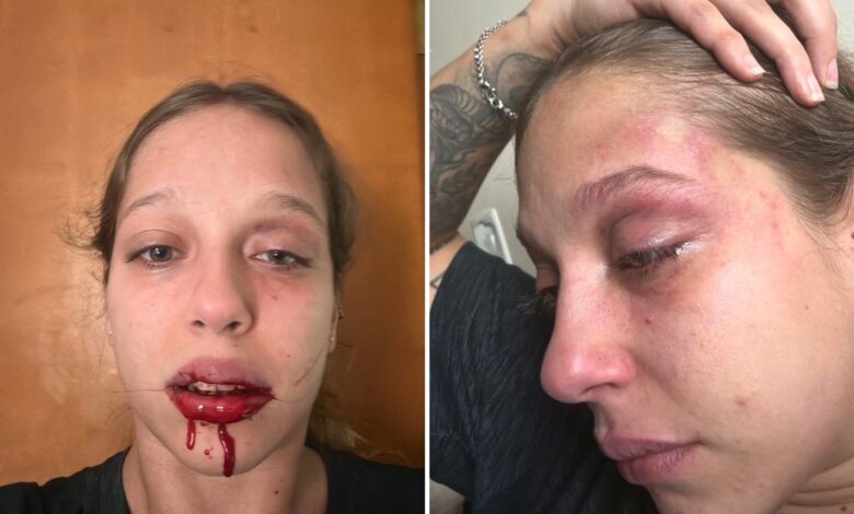 Violência doméstica em Goiânia: jovem denuncia agressão brutal de empresário