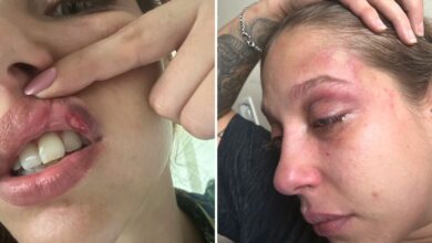 Empresário é detido em Goiânia após denúncia de agressão grave contra ex-namorada