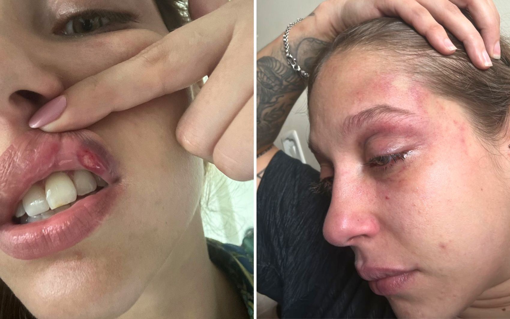 Empresário é detido em Goiânia após denúncia de agressão grave contra ex-namorada