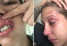 Vítima de agressão em Goiânia relata medo constante após prisão de empresário