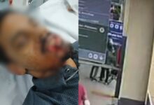 Homem é esfaqueado na boca ao tentar apartar briga em terminal de Goiânia