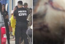 Laudo aponta lesões fatais em criança de dois anos sob cuidados de babá em Goiás