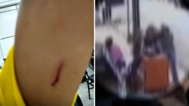 Ataque com tesoura em Goiás: funcionária é ferida por colega após flagrar uso de celular no trabalho