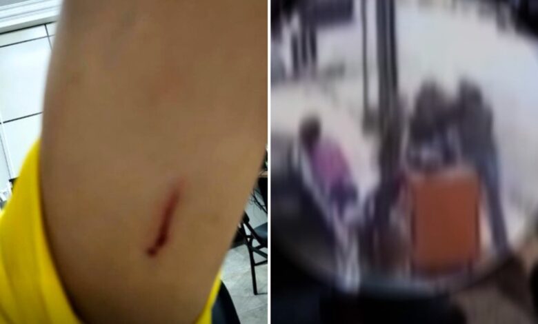 Ataque com tesoura em Goiás: funcionária é ferida por colega após flagrar uso de celular no trabalho
