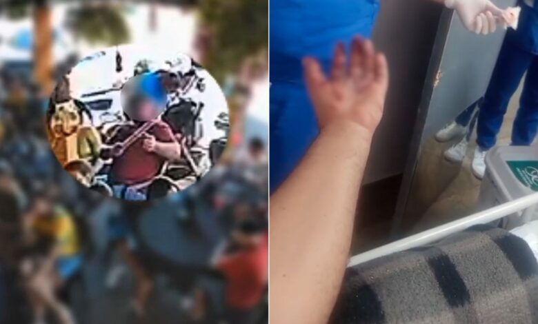 Acidente com fogos de artifício deixa torcedor ferido durante jogo do Brasil em Goiás