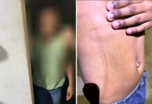 Maus-tratos em Aparecida de Goiânia: Criança era agredida com fio e utensílios de cozinha