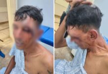 Justiça de Goiás aceita denúncia e cinco guardas municipais viram réus por tortura e sequestro