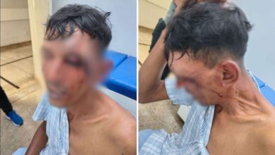 Justiça de Goiás aceita denúncia e cinco guardas municipais viram réus por tortura e sequestro