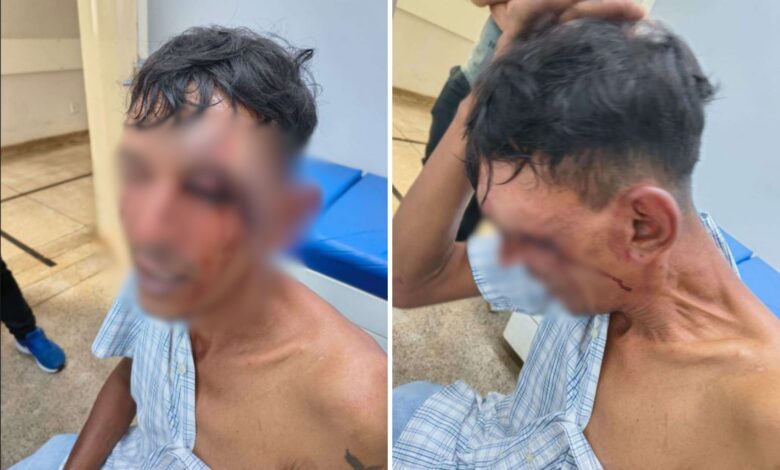 Justiça de Goiás aceita denúncia e cinco guardas municipais viram réus por tortura e sequestro