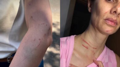 Enfermeira é agredida por paciente após negar atendimento em hospital lotado no DF