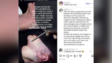 Família acusa médico de manter fotos de paciente morta após plástica para promoção