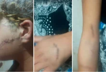 Homem foragido é preso após atacar ex-companheira com golpes de faca em Goiás
