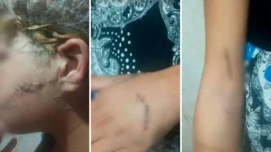 Homem foragido é preso após atacar ex-companheira com golpes de faca em Goiás