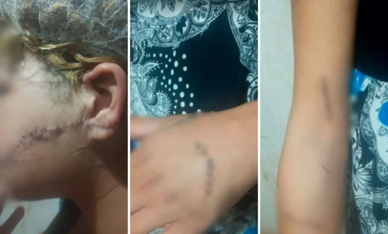 Homem foragido é preso após atacar ex-companheira com golpes de faca em Goiás