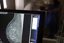 Planos de saúde passam a cobrir mamografia digital sem limite de idade