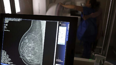 Planos de saúde passam a cobrir mamografia digital sem limite de idade
