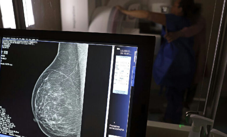 Planos de saúde passam a cobrir mamografia digital sem limite de idade