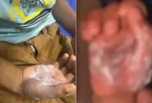 Polícia prende mãe suspeita de torturar filho de 7 anos com colher quente em Cidade Ocidental
