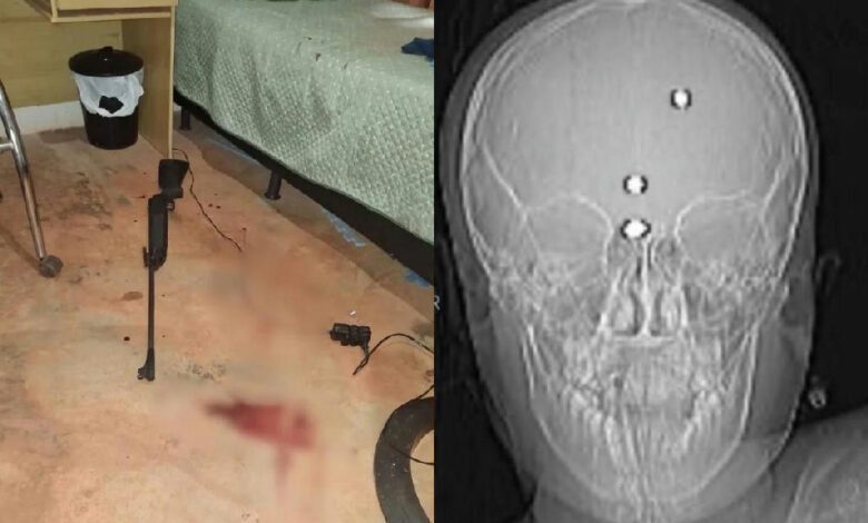 Criança baleada por arma de chumbinho acorda e pede para morar com avós em Anápolis