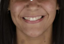 Operadora de caixa é presa após dentista reconhecê-la em parque