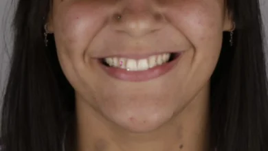 Operadora de caixa é presa após dentista reconhecê-la em parque