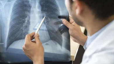 País amplia opções terapêuticas com aval da Anvisa para novos remédios contra câncer