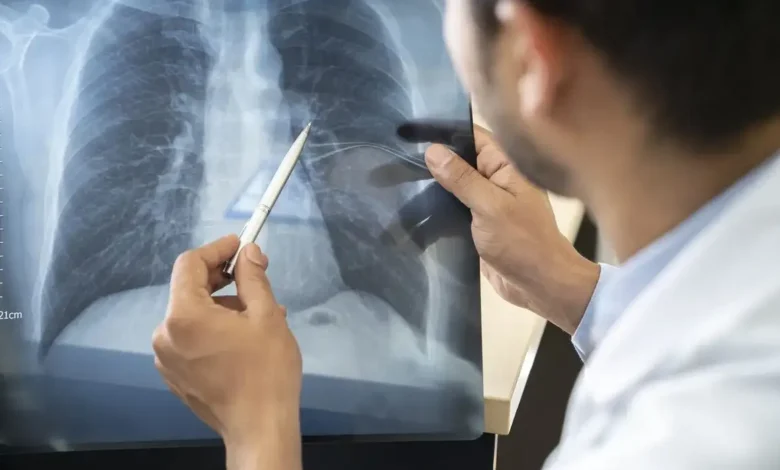 País amplia opções terapêuticas com aval da Anvisa para novos remédios contra câncer