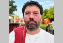 São Luís promete punir jogador que agrediu o jornalista Vinicius de Paula após jogo contra Goianésia